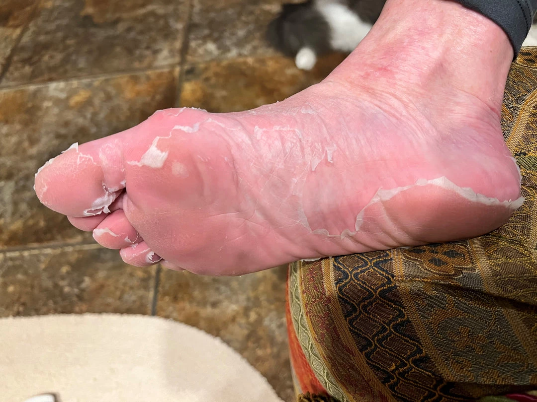 Baby Foot ACCESSORIES