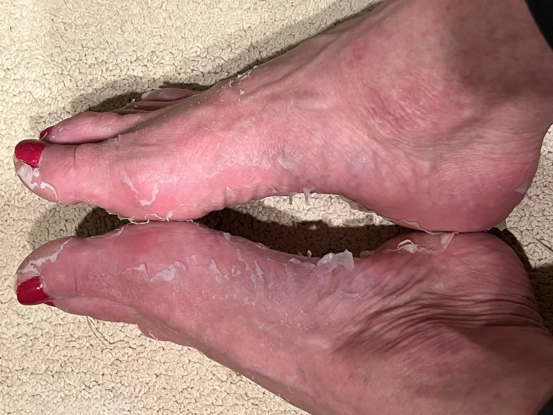 Baby Foot ACCESSORIES